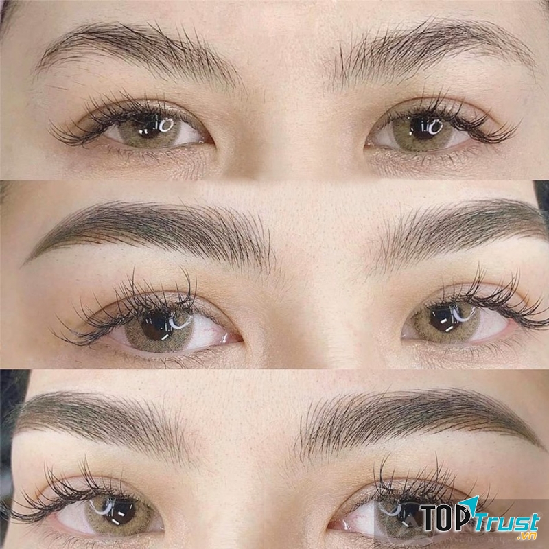 Viện Thẩm mỹ Quốc Tế Linh Anh