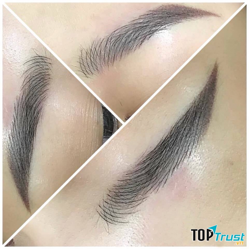 Viện Thẩm mỹ Quốc Tế Linh Anh