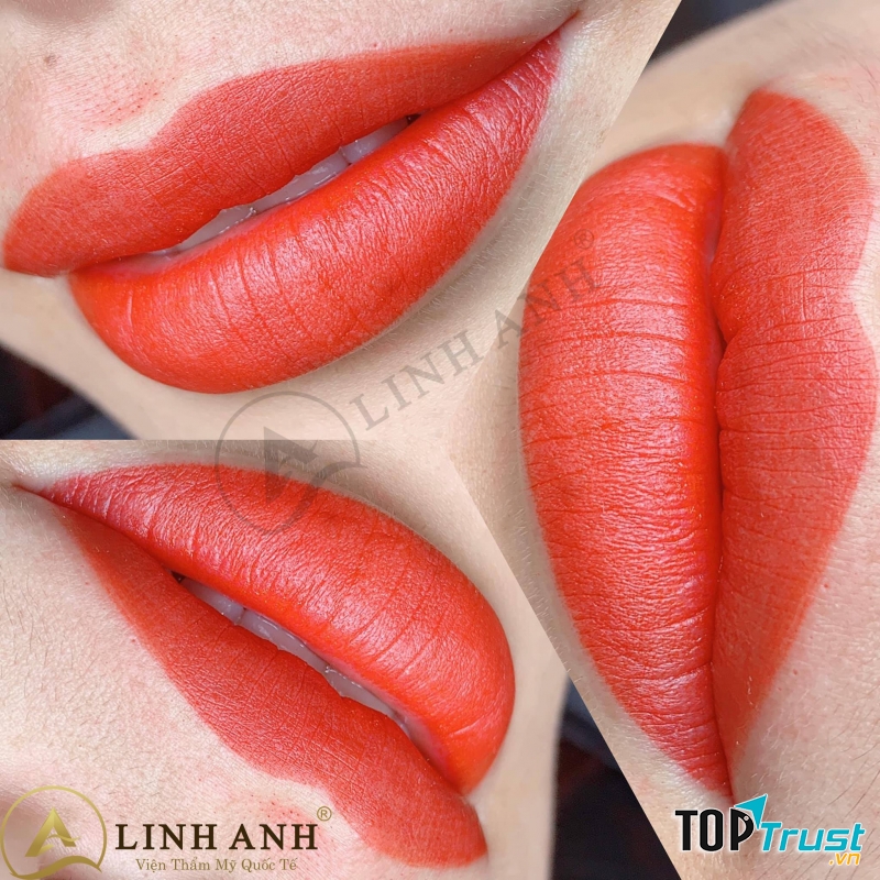 VIỆN THẨM MỸ QUỐC TẾ LINH ANH