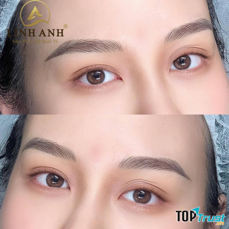 VIỆN THẨM MỸ QUỐC TẾ LINH ANH