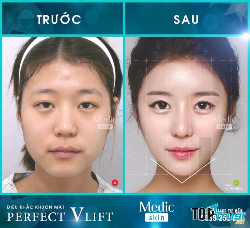 Viện Thẩm Mỹ Quốc Tế Medic Skin