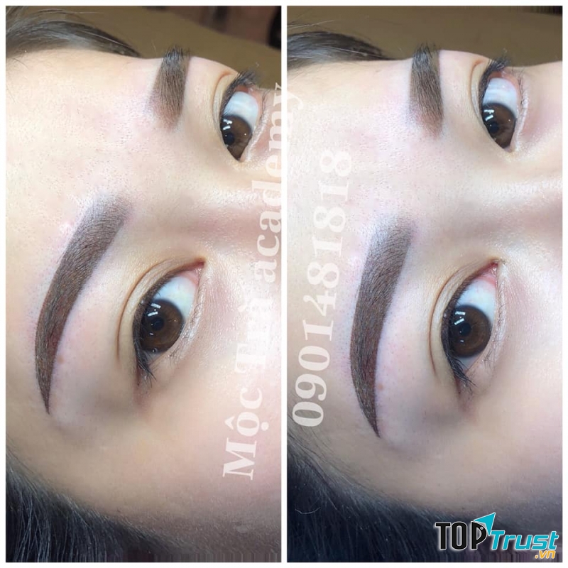 Viện Thẩm Mỹ Quốc Tế Mộc Trà