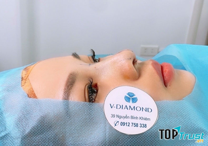 Viện thẩm mỹ quốc tế V-diamond