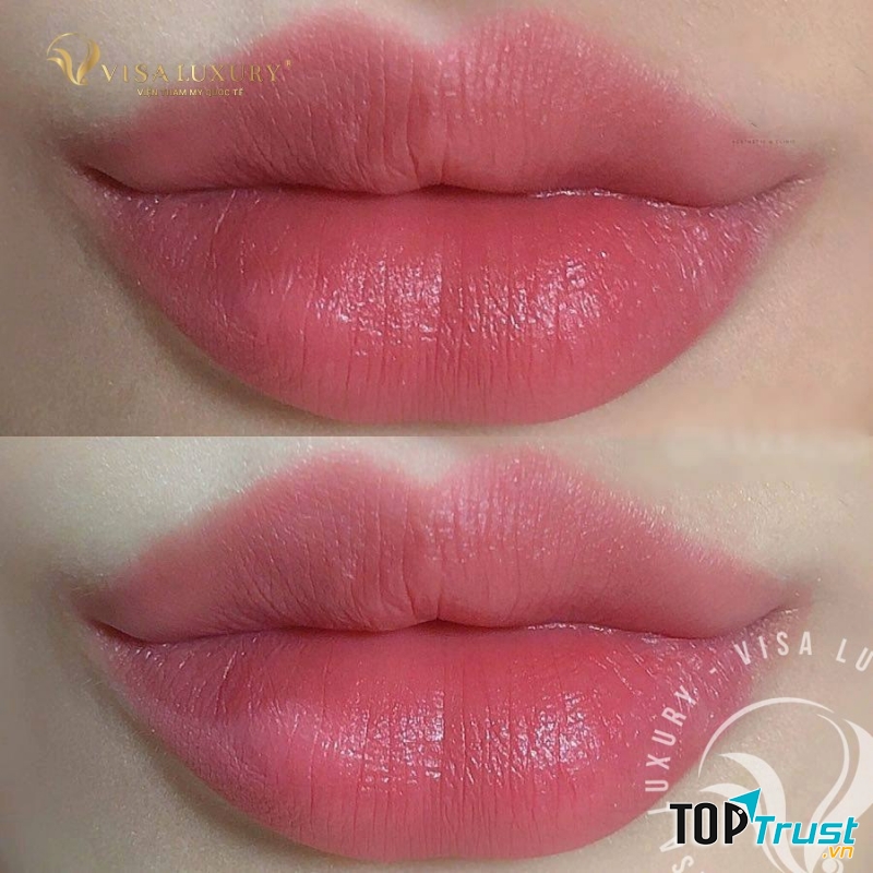 Viện Thẩm Mỹ Quốc Tế VISA