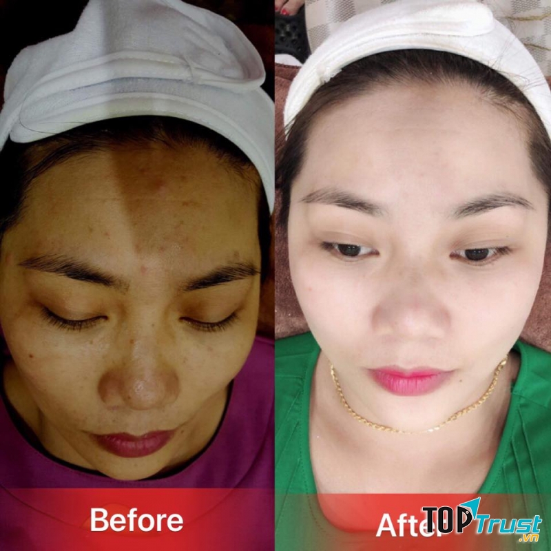 Viện Thẩm mỹ Reborn Thanh Hóa