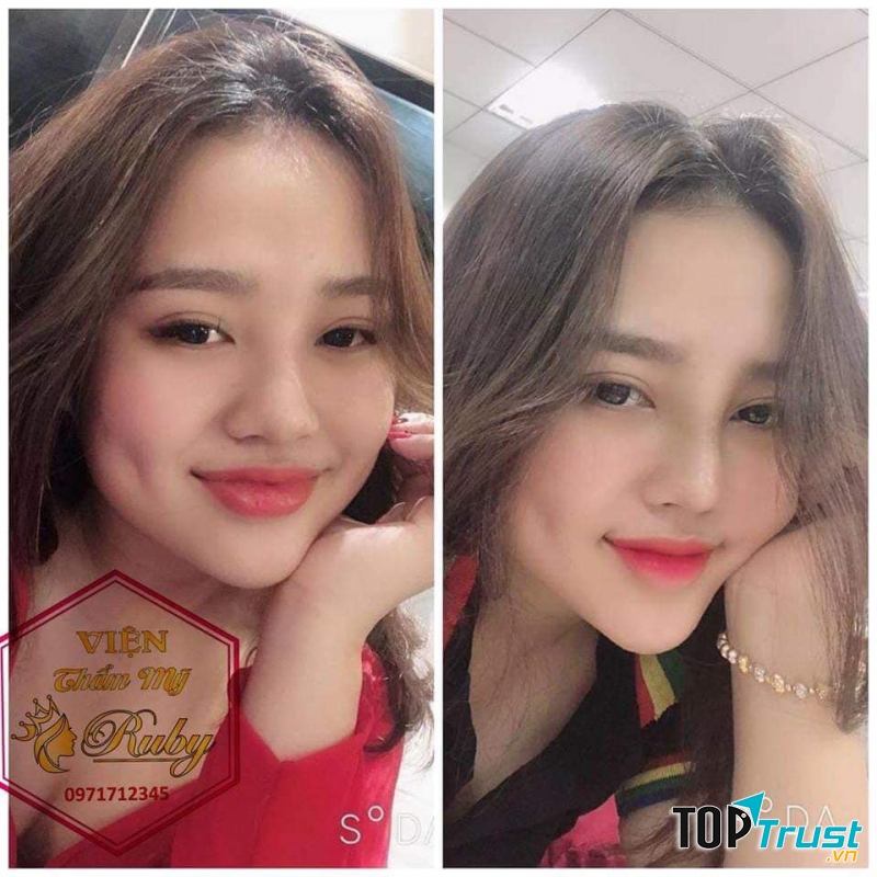 Viện Thẩm Mỹ Ruby