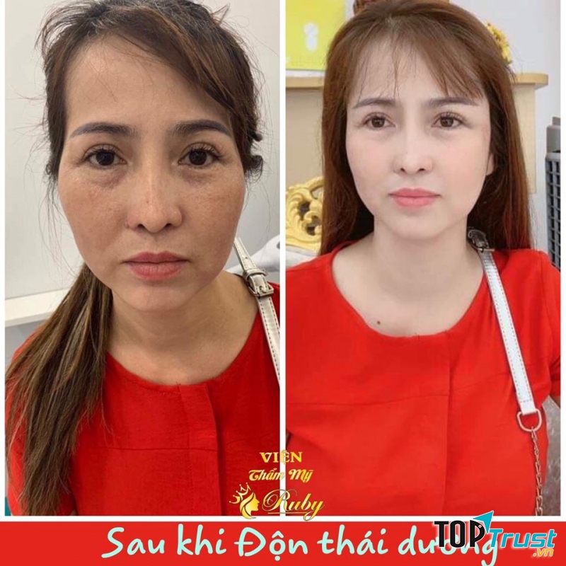 Viện Thẩm Mỹ Ruby