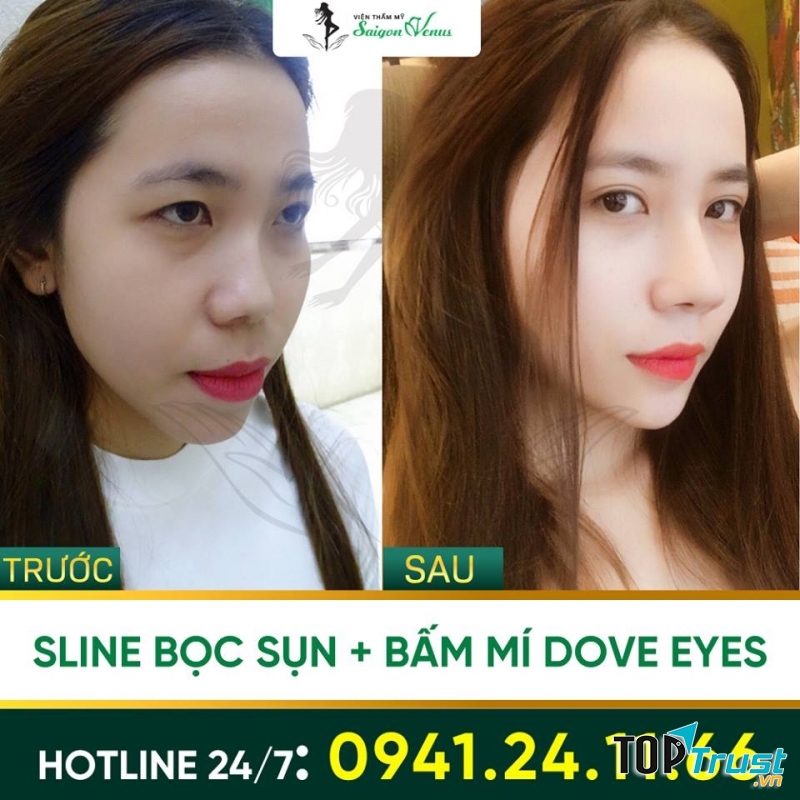 Viện Thẩm Mỹ Sài Gòn Venus