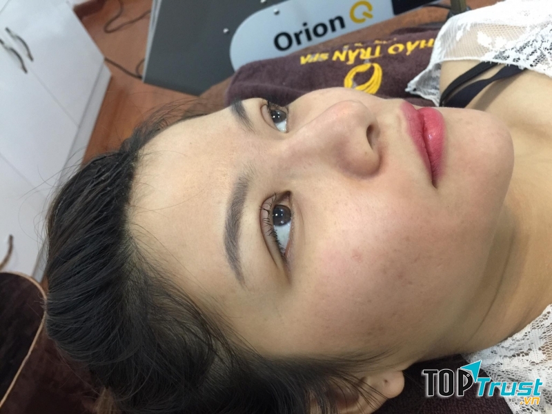 Viện thẩm mỹ Thảo Trần