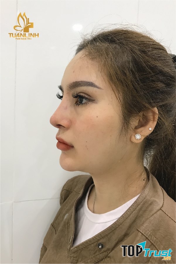 Viện Thẩm Mỹ Tuấn Linh