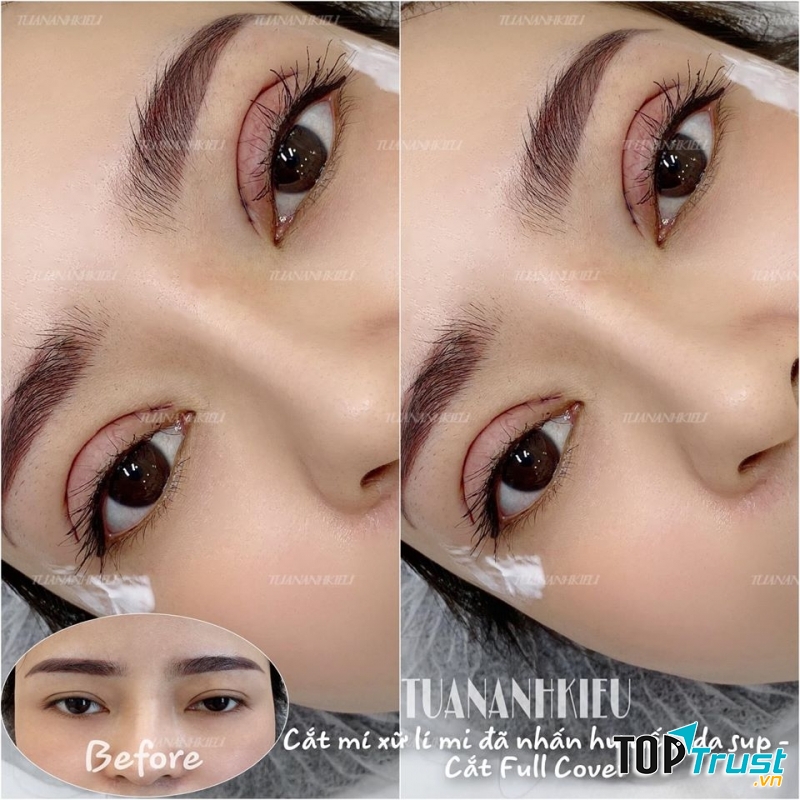 Viện Thẩm Mỹ TUANANHKIEU