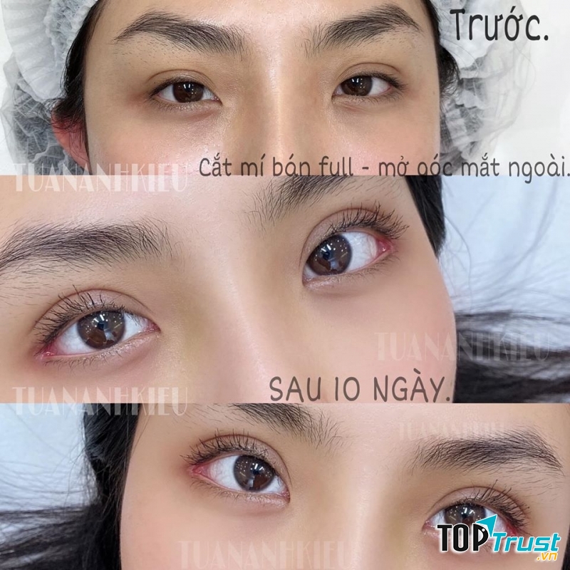 Viện Thẩm Mỹ TUANANHKIEU