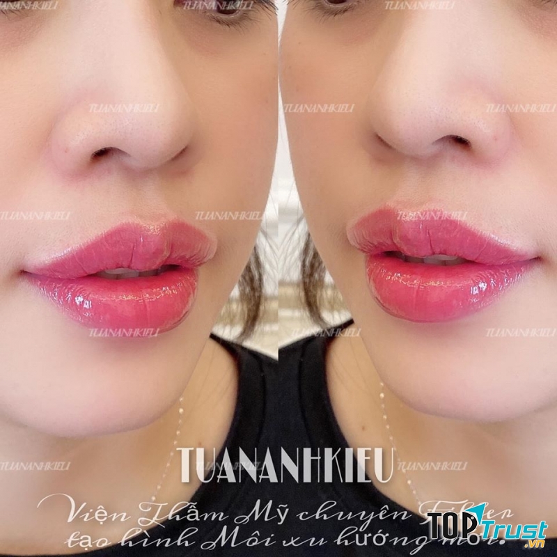 Viện Thẩm Mỹ TUANANHKIEU