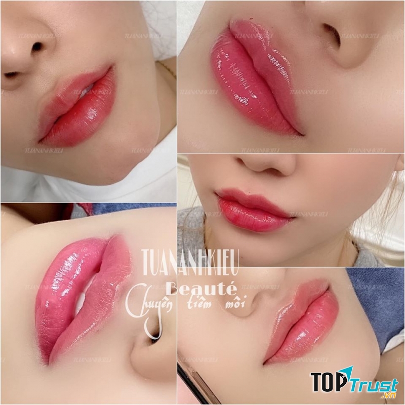 Viện Thẩm Mỹ TUANANHKIEU