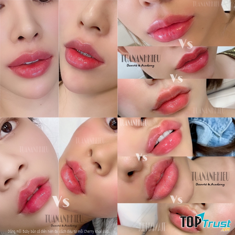 Viện thẩm mỹ TUANANHKIEU BEAUTY