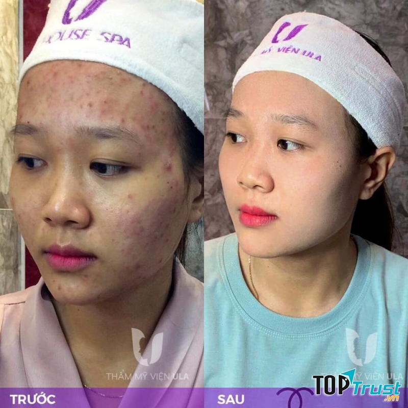 Viện Thẩm Mỹ Ula