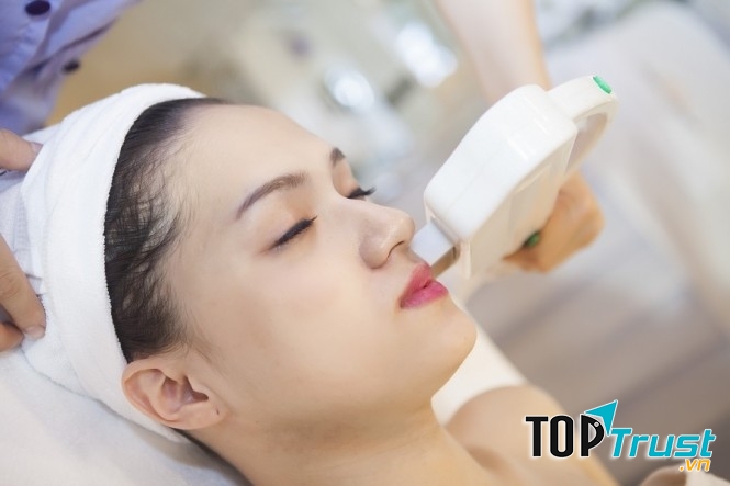 Khách hàng trị nám tại Viện thẩm mỹ Văn Trường