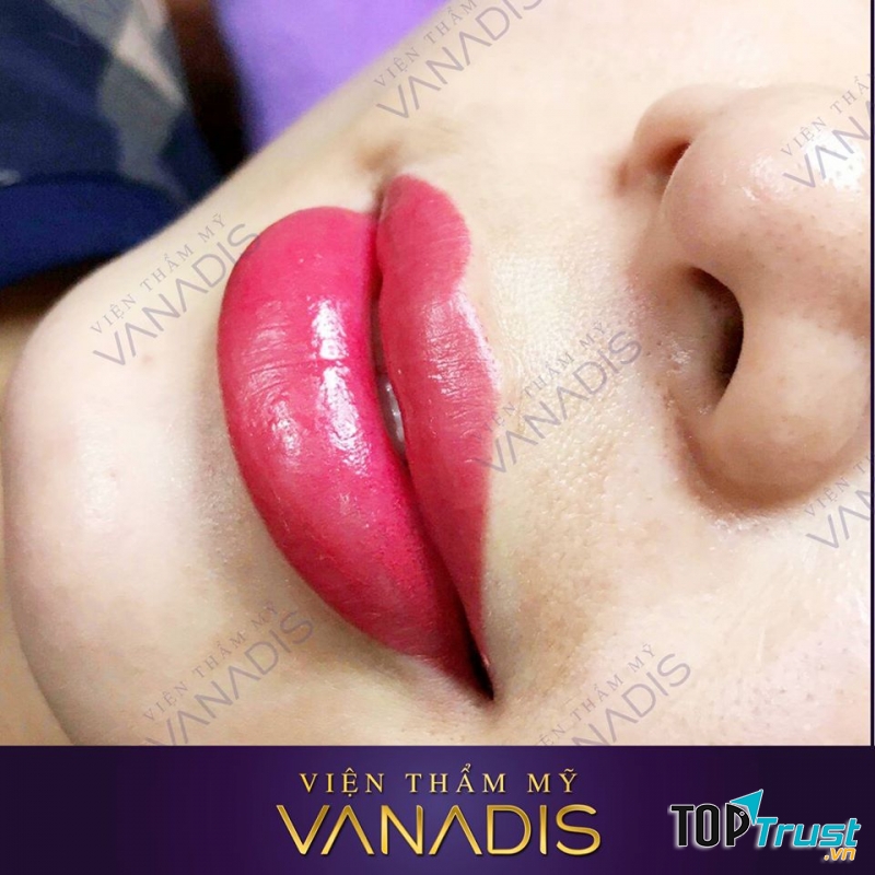 Viện Thẩm Mỹ Vanadis