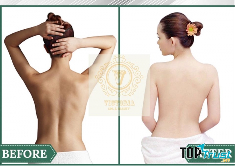 Viện Thẩm Mỹ Victoria