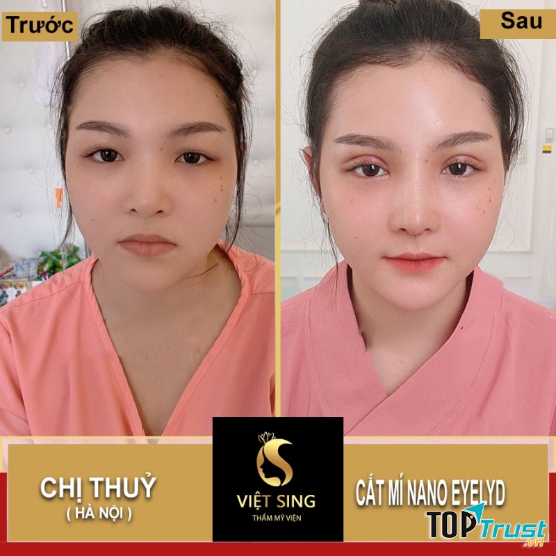 Viện Thẩm Mỹ Việt Sing