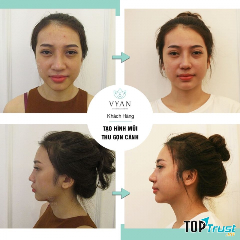 Viện Thẩm Mỹ Vy An