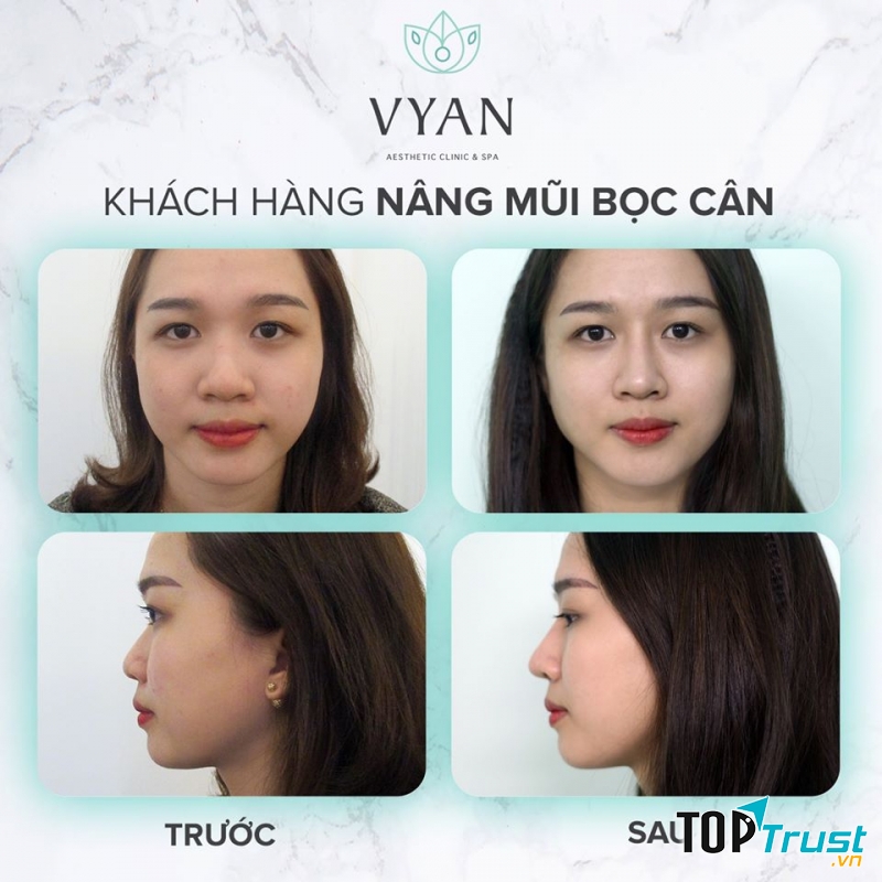 Viện Thẩm Mỹ Vy An