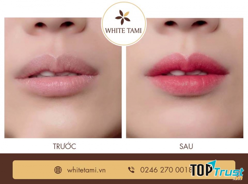 Viện Thẩm Mỹ WhiteTami