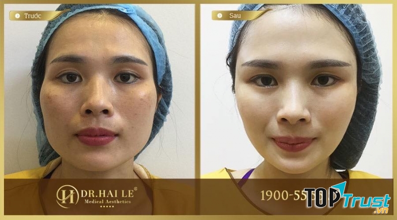 Viện Thẩm Mỹ Y Khoa Dr.Hải Lê