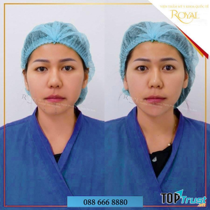 Viện Thẫm Mỹ Y Khoa Quốc Tế Royal Clinic