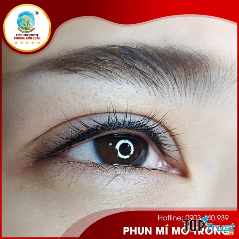 Viện Thẩm Mỹ Y Khoa Trương Kiều Xuân