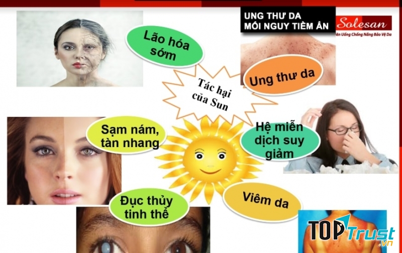 Viên uống chống nắng Solesan