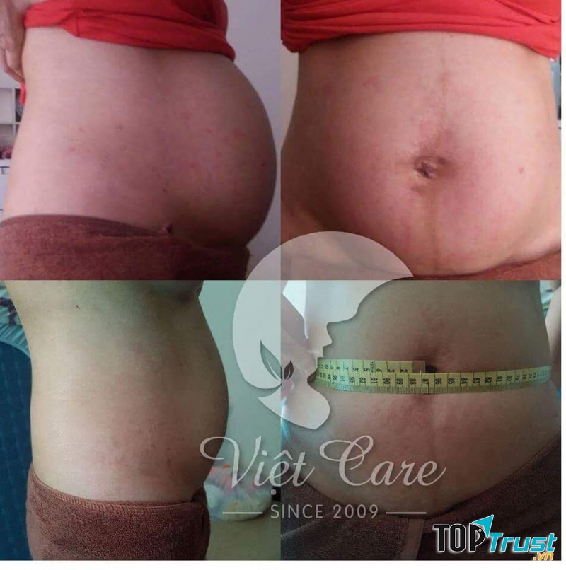 Viet-Care Vĩnh Phúc massage bầu và làm đẹp sau sinh