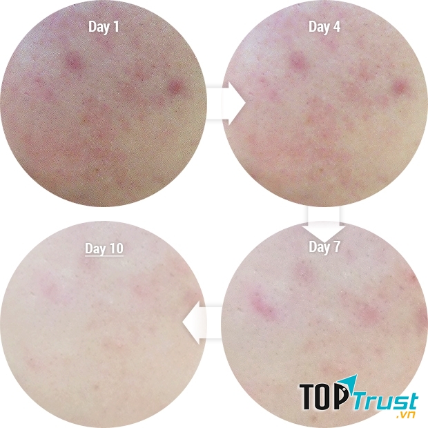 Hiệu quả rõ rệt của sản phẩm