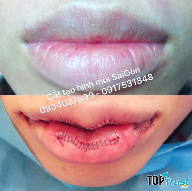 Vivian ThienVan Beauty