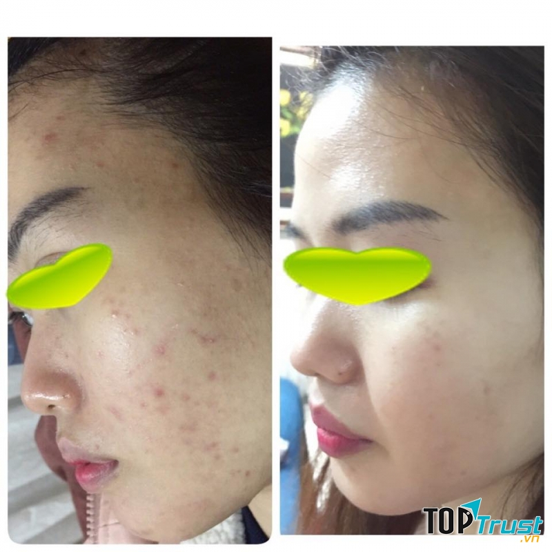 VSKIN Beauty