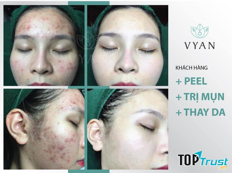 Vy An Spa