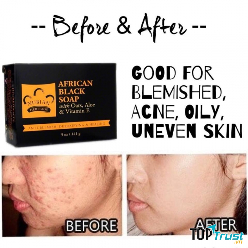 Xà Phòng Đen Trị Mụn Nubian Heritage African Black Soap