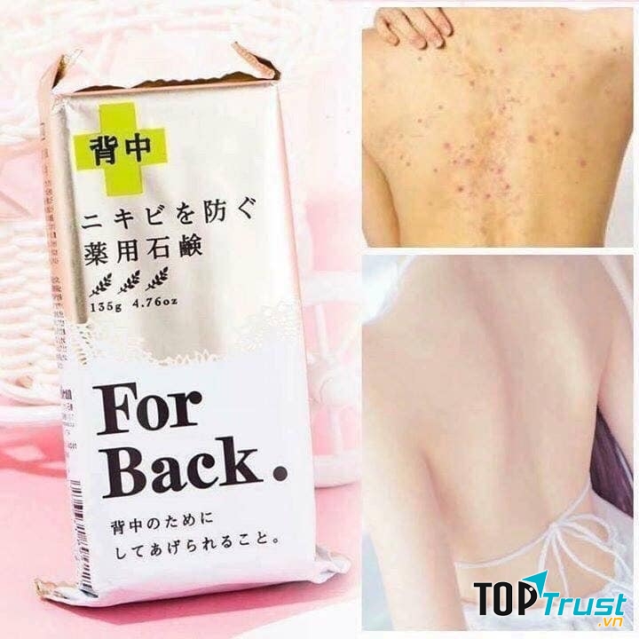 Xà phòng trị mụn lưng For Back Medicated Soap