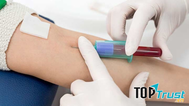 Xander - Trung tâm xét nghiệm tại nhà