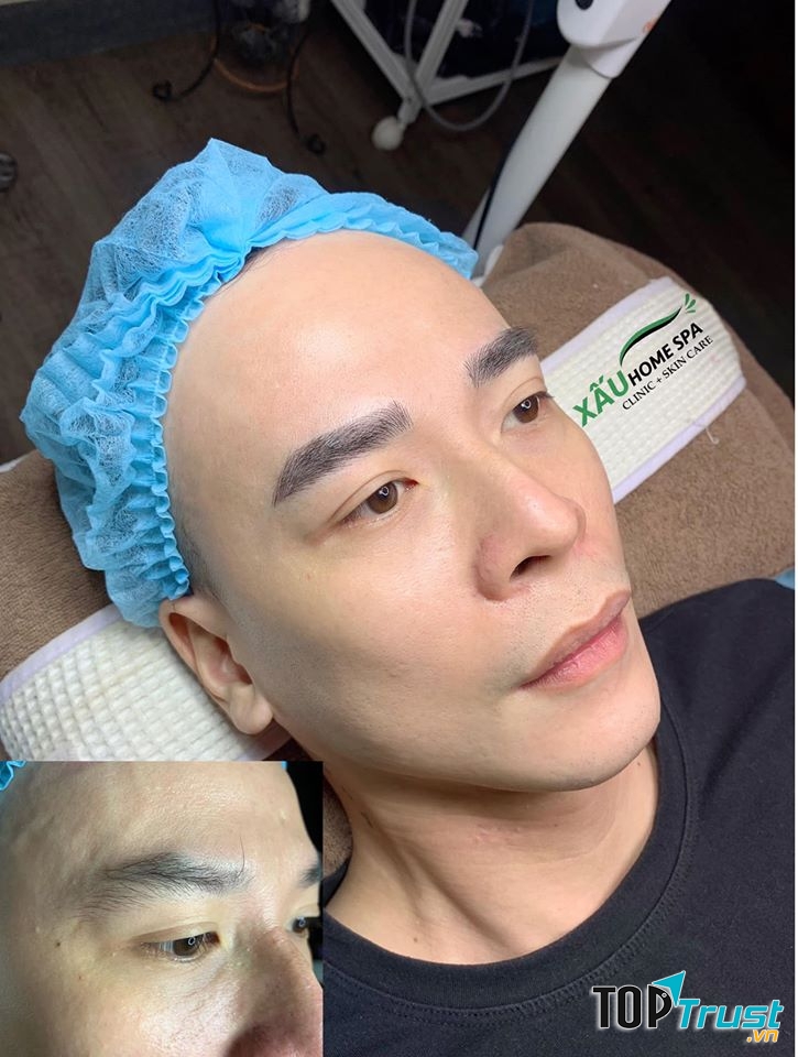 Xấu Home Spa
