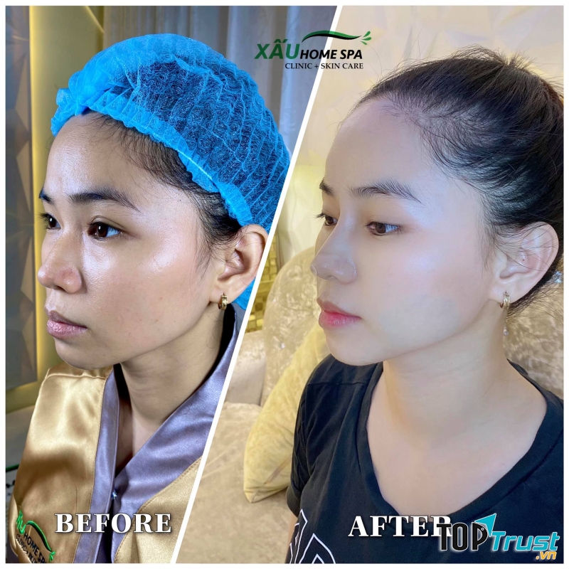 Xấu Home Spa