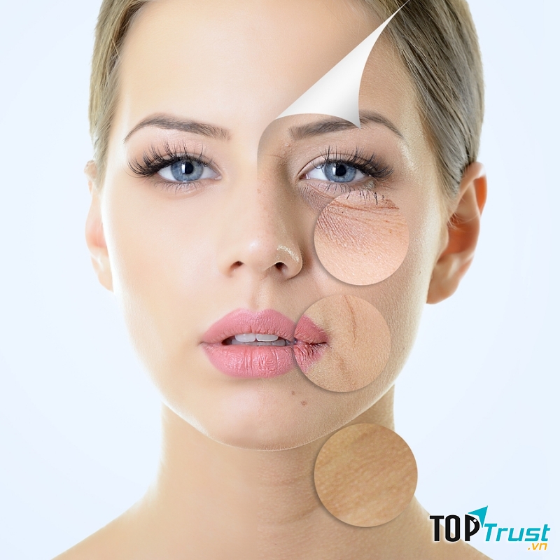 Trị quầng thâm mắt bằng sữa tươi