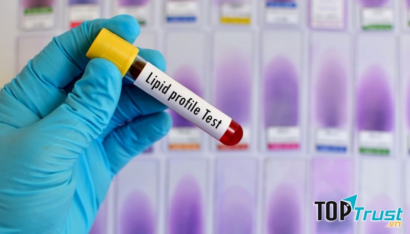 Xét nghiệm li-pit