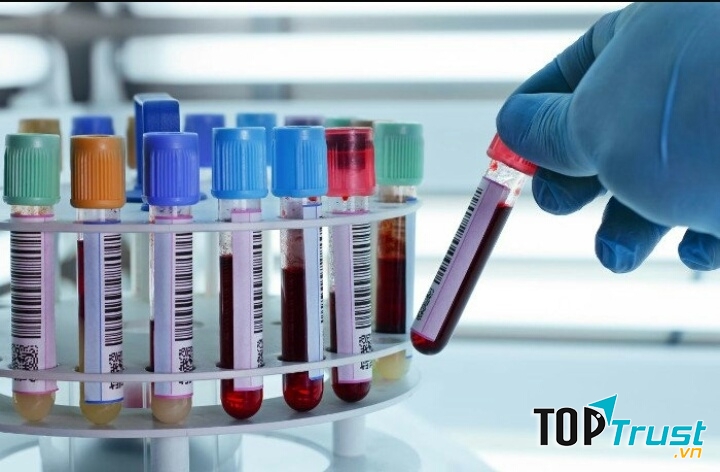 Xét nghiệm máu