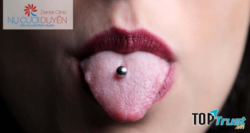 Xâu khuyên không làm bạn đẹp hơn mà khiến răng bạn dễ bị tổn thương.
