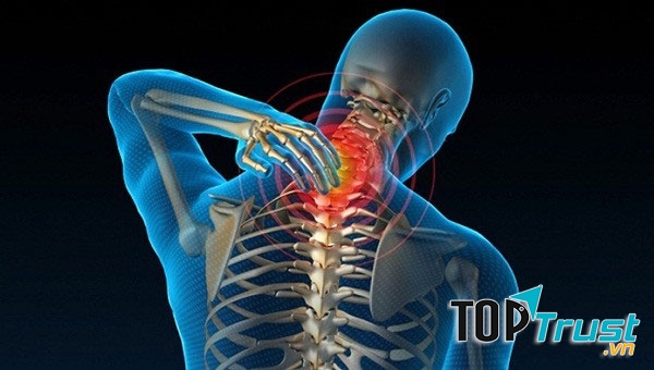 Xương sườn cổ xuất hiện ở người với tỉ lệ 1:500