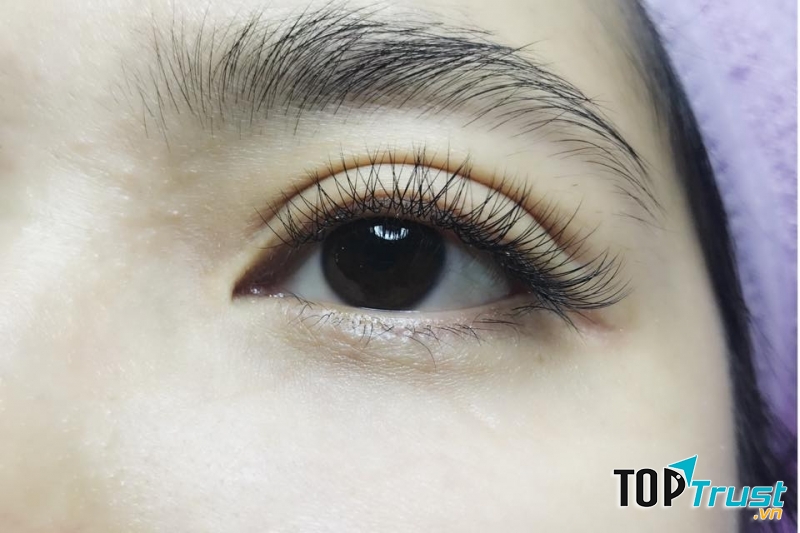 Yến Vịt Nối Mi