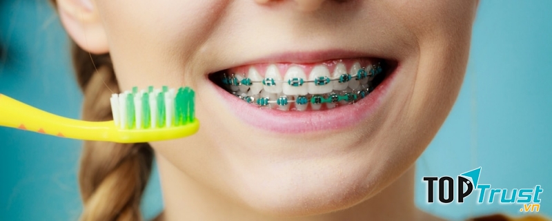 Bàn chải đánh răng cho răng niềng tốt nhất hiện nay