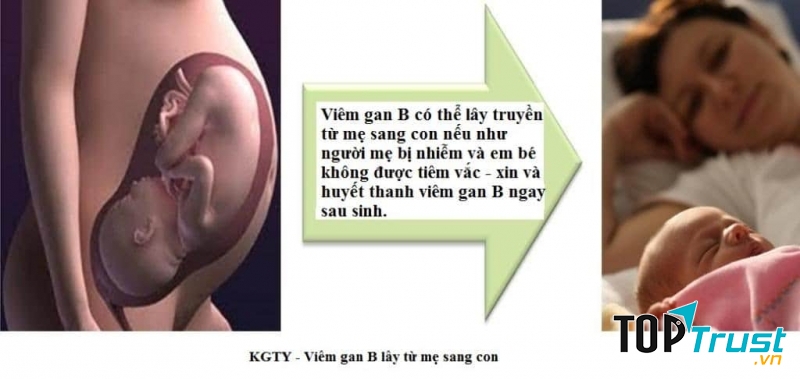 Bệnh nguy hiểm  lây truyền từ mẹ sang con bạn nên biết