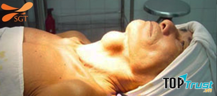 Bệnh viện chữa bướu cổ tốt nhất Việt Nam hiện nay